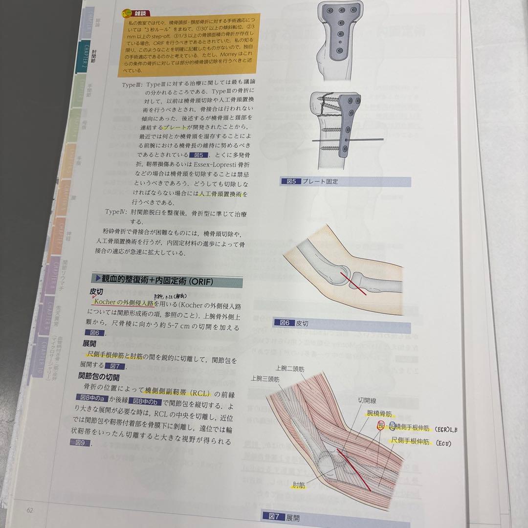 【裁断】手の外科私のアプローチ